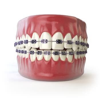 Orthodontics